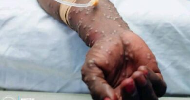 RDC – Kasaï: Cinq cas de M-pox confirmés à la prison centrale de Tshikapa